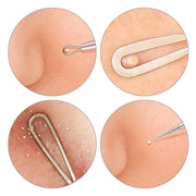 Acne Needle Blackhead Blemish Pimple Extractor Remover