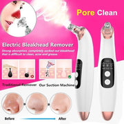 Blackhead Remover Black Head Remover