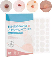 Skin Tag Remover Acne Patch Pimple Blemish Stickers