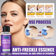 Skin Tag Mole Wart Remover Liquid