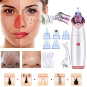 Blackhead Remover Black Head Remover